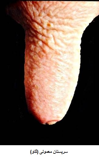 سرپستان سالم گاو بدون تغییر رنگ، التهاب یا رینگ ناشی از دوشش، نشان‌دهنده دوشش صحیح و رعایت اصول بهداشتی در شیردوشی